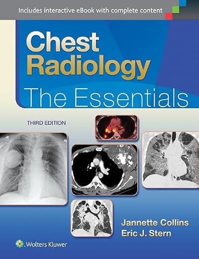 Chest Radiology: The Essentials (Essentials Series)