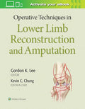 Operative Techniques in Lower Limb Reconstruction and Amputation
