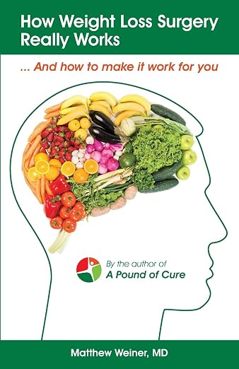 How Weight Loss Surgery Really Works