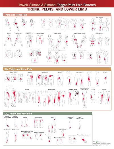 Travell, Simons & Simons’ Trigger Point Pain Patterns Wall Chart: Trunk, Pelvis, and Lower Limb