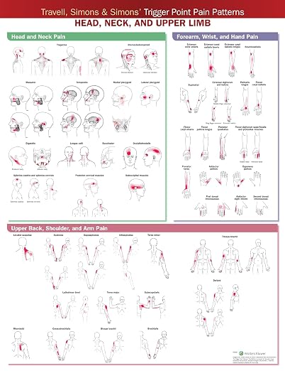 Travell, Simons & Simons’ Trigger Point Pain Patterns Wall Chart: Head, Neck, and Upper Limb