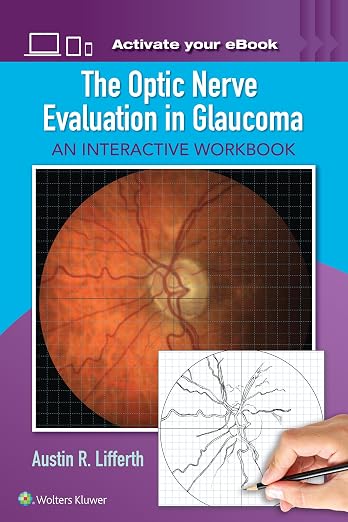 The Optic Nerve Evaluation in Glaucoma: An Interactive Workbook